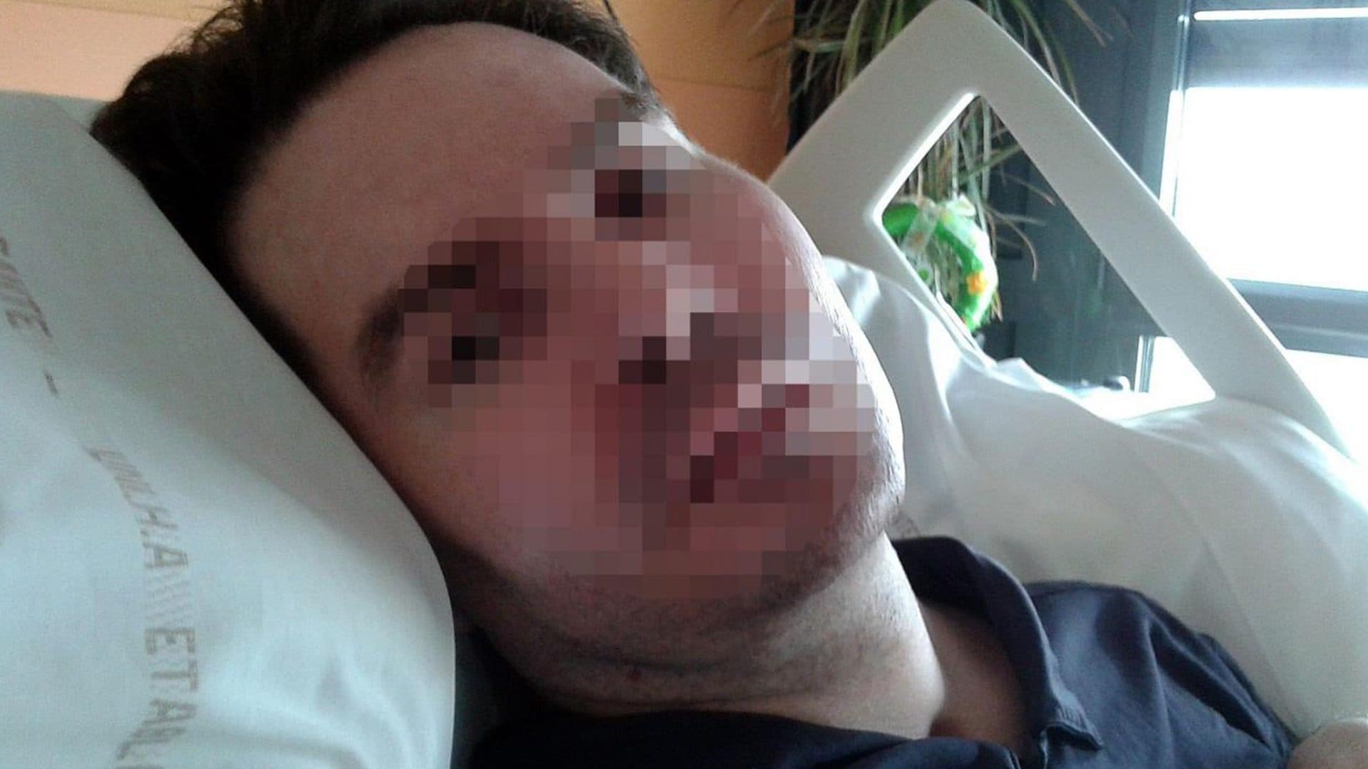 Réponses à 10 affirmations courantes favorables à l'euthanasie de Vincent Lambert.