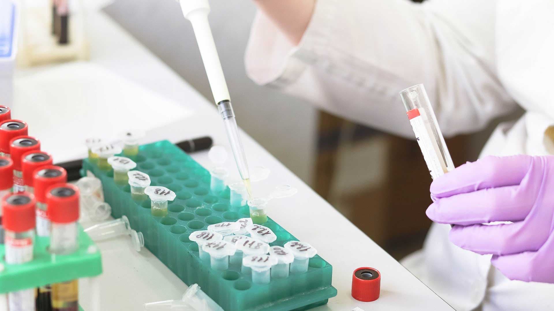 Avec l'ivermectine, ces chercheurs australiens auraient-ils trouvé une piste contre le coronavirus ?