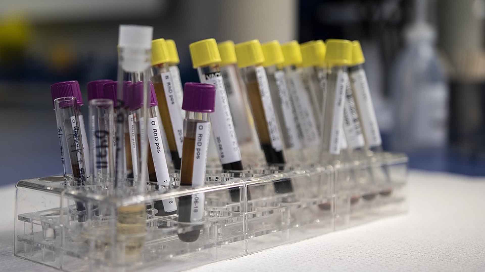 Coronavirus : trois médecins généralistes pensent avoir trouvé un possible remède