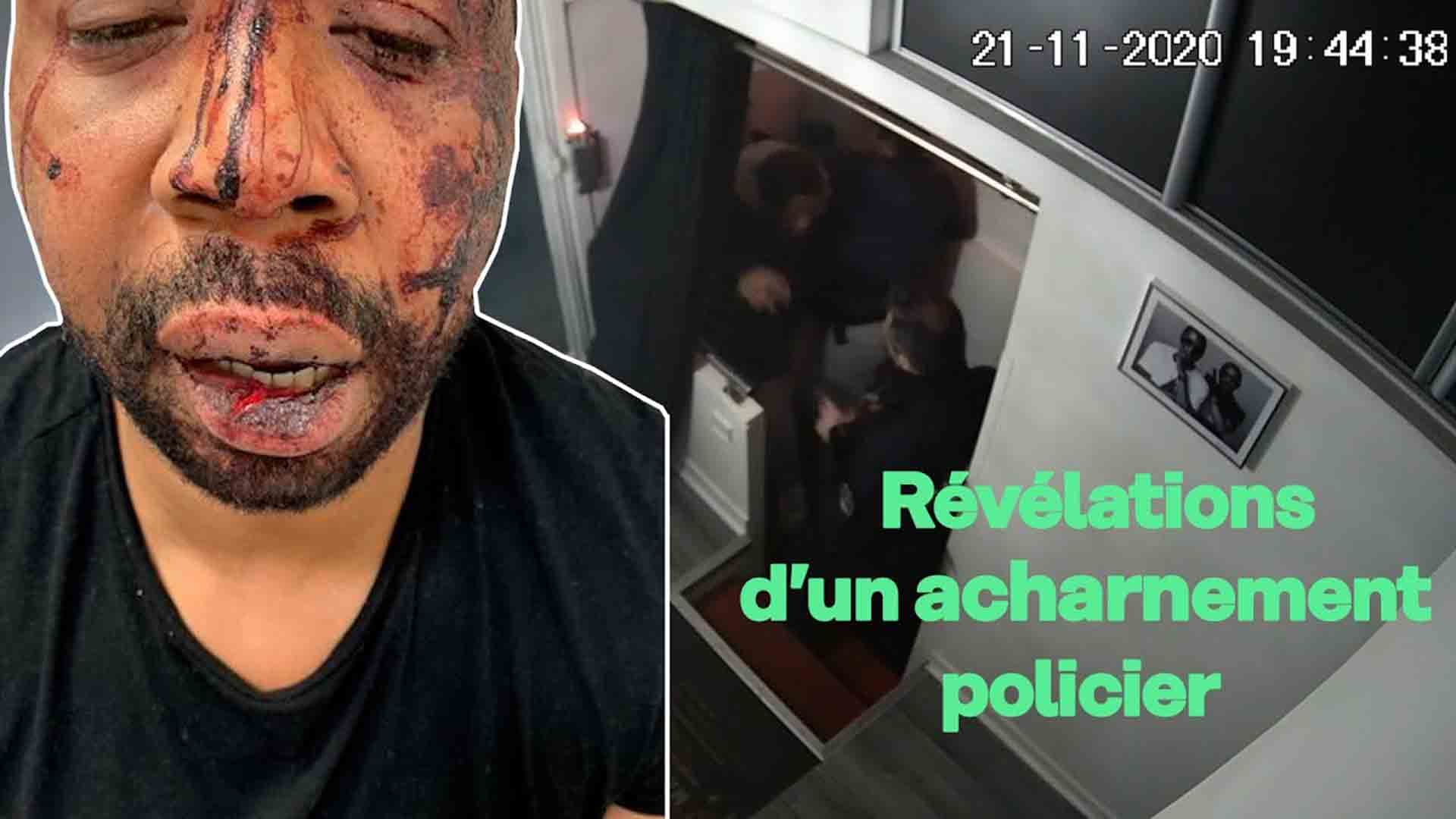 Il ne portait pas de masque : trois policiers le tabassent chez lui [VIDEO]