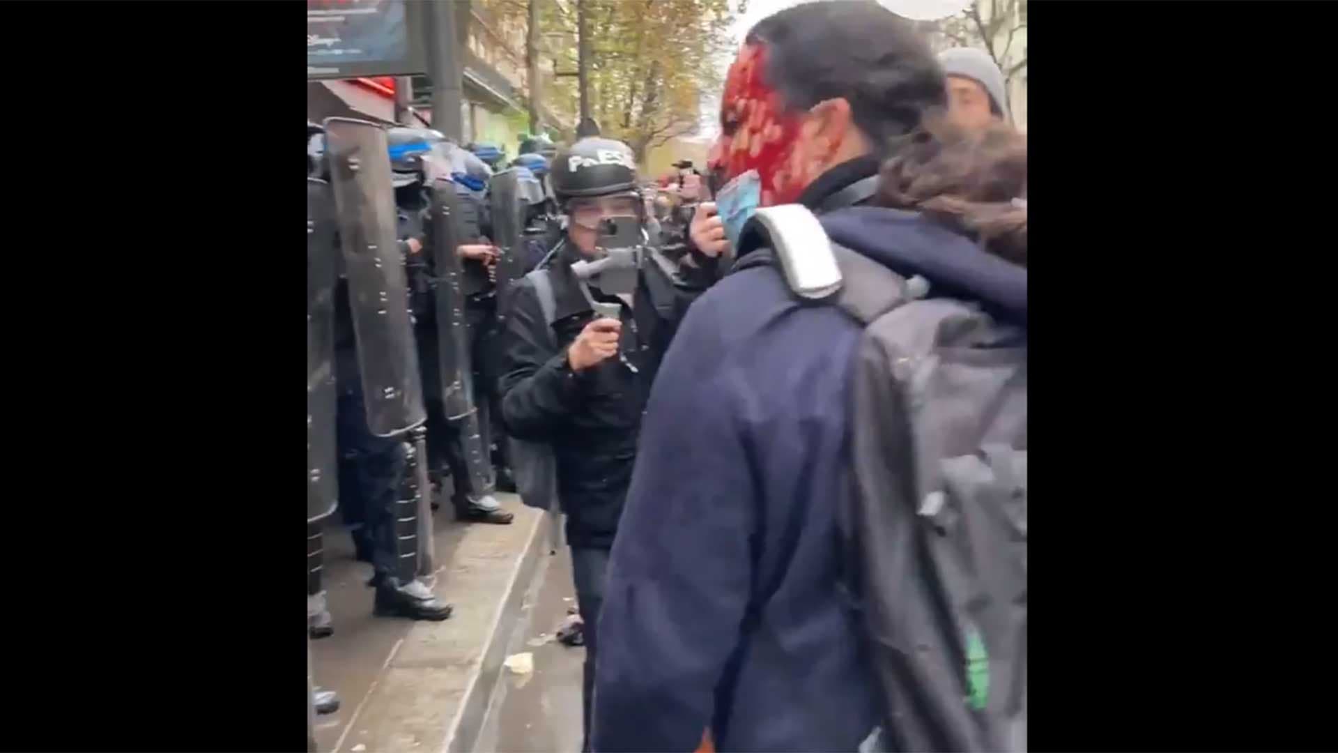 Manifestation : un homme ensanglanté, BFM décrit la blessure comme du maquillage