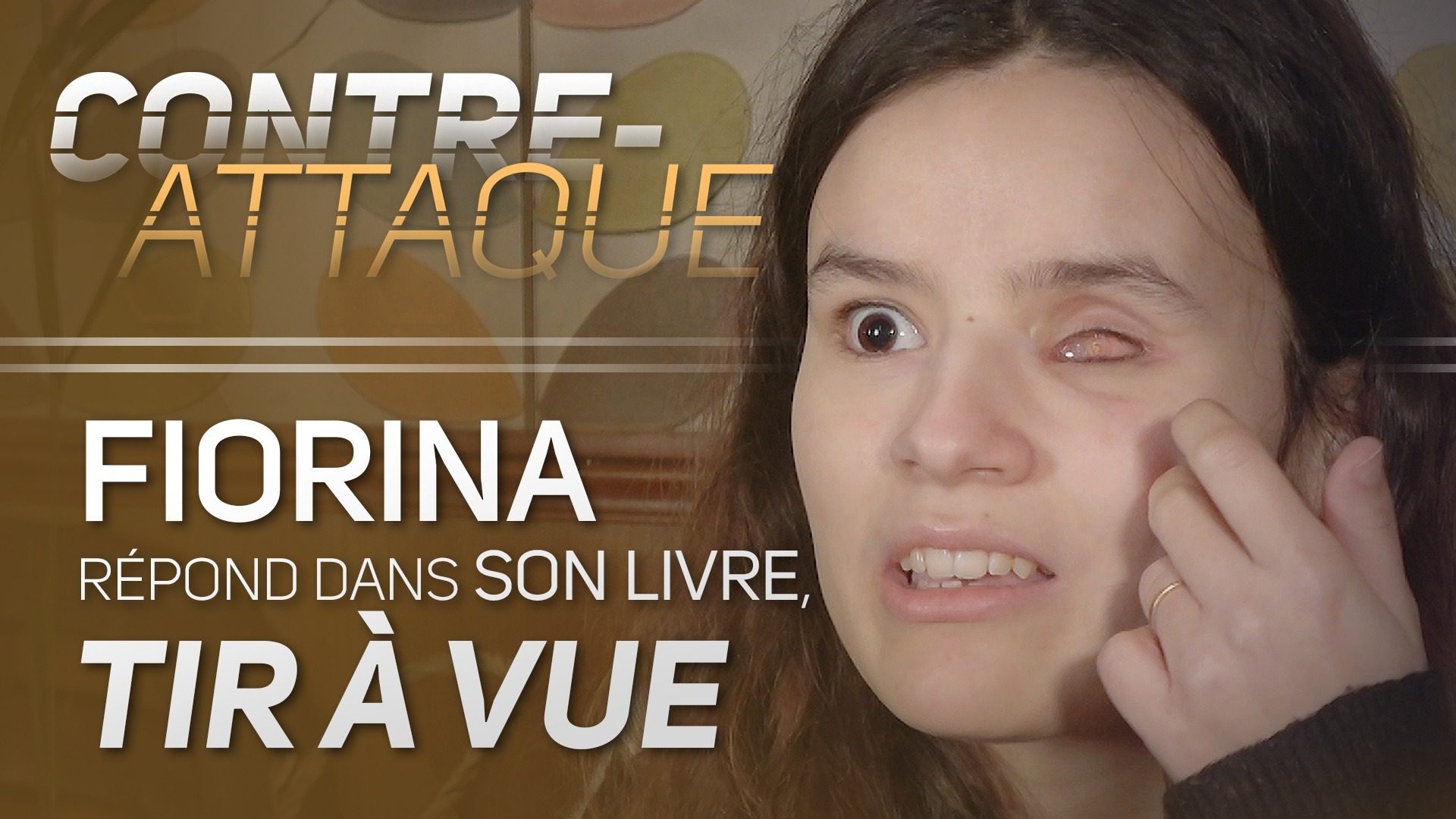 Éborgnée par Macron : Fiorina contre-attaque !